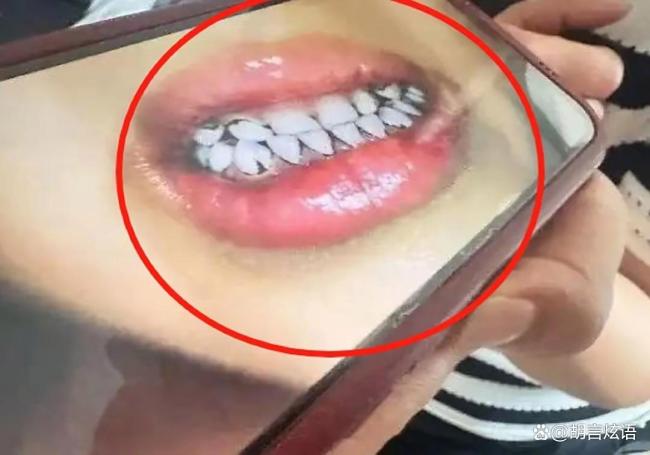 幼儿园铅中毒源头尚未查明 食品安全引深思(图1)