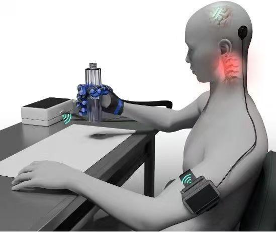 全球首个植入式脑机接口三类医疗器械获批上市(图3)