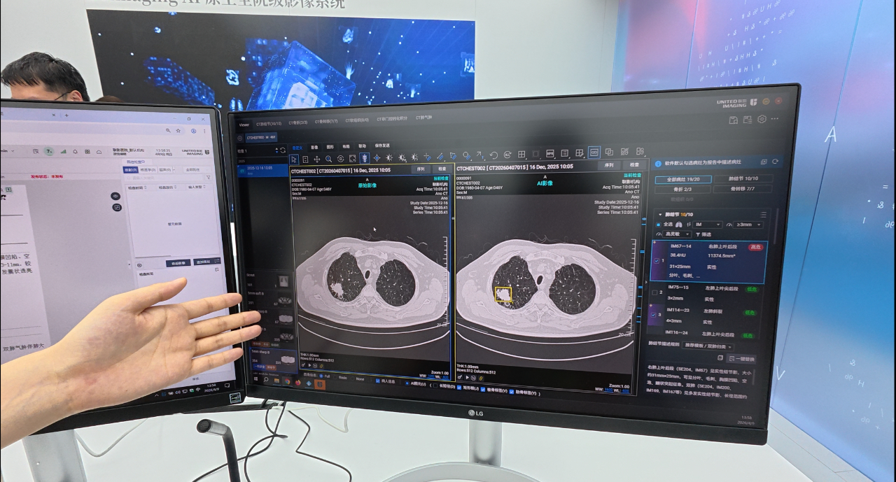 CMEF观察：芯片控意念戒指管健康轮椅自己走(图2)