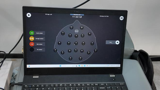 “意念”控制下肢行走这款“成都造”有望明年进入商业化应用(图3)