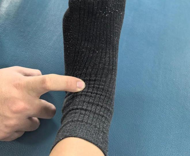 【名医名科】脑卒中后踝关节如何进行康复训练？(图4)