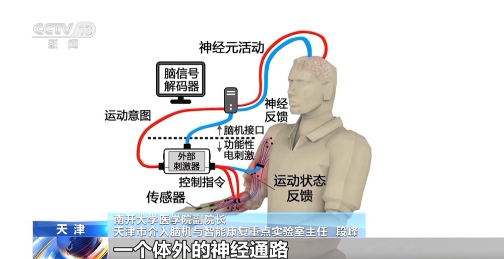 我国脑机接口技术走向临床 受试者体验如何？(图6)
