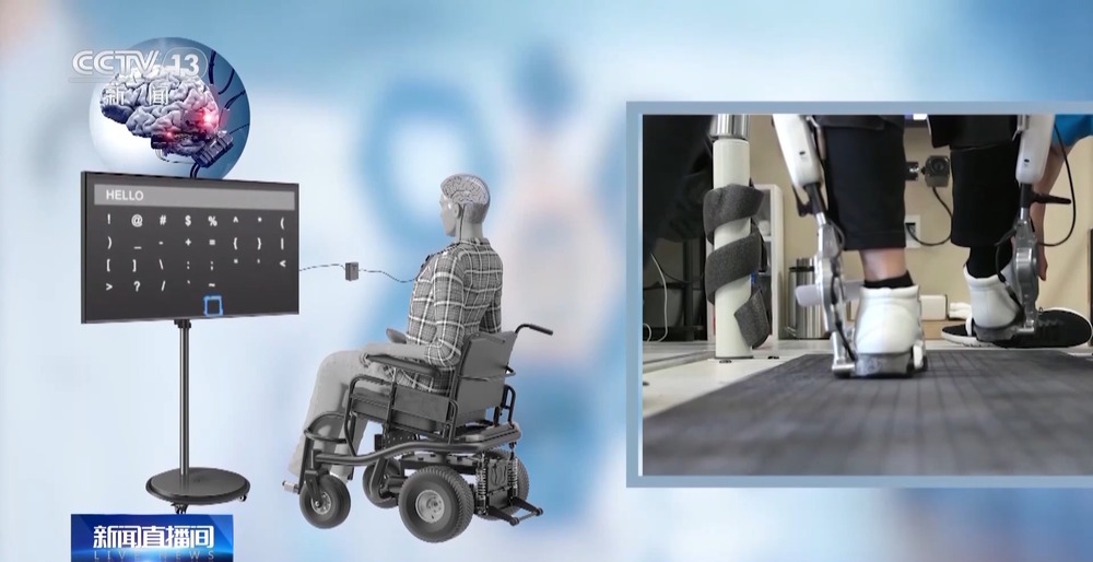 我国脑机接口技术走向临床 受试者体验如何？(图7)