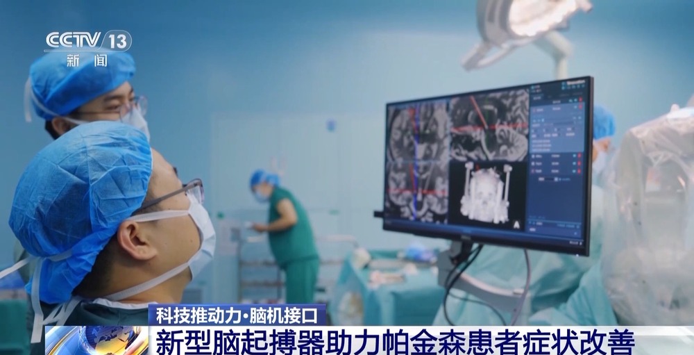 我国脑机接口技术走向临床 受试者体验如何？(图12)