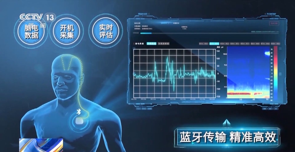 我国脑机接口技术走向临床 受试者体验如何？(图13)
